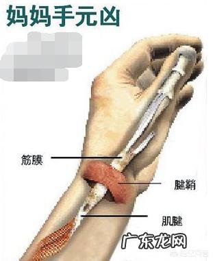 不小心患上腱鞘炎应该如何护理?
