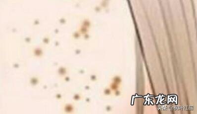 有哪些护肤品可以淡化晒斑?