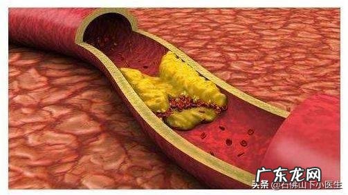 练习深蹲对减肥有什么好处?