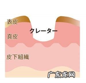 如何快速祛湿、祛痘。在线等！急？