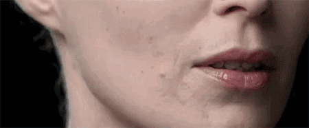 面部肌肤下垂,做提升需要多长时间恢复?能保持多久? 提拉面部紧致肌肤防止下垂