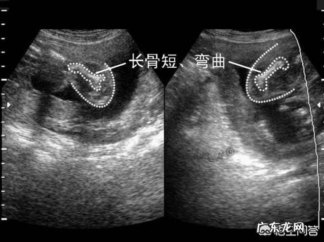 怀孕有30周了,睡觉总是平躺,会不会影响胎儿缺氧?