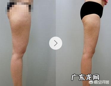 吸脂减肥会让人变得很轻吗?