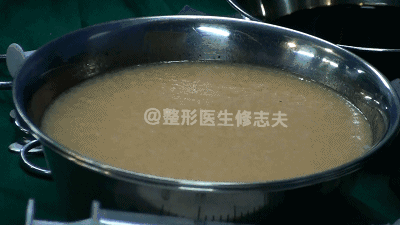 吸脂减肥会让人变得很轻吗?