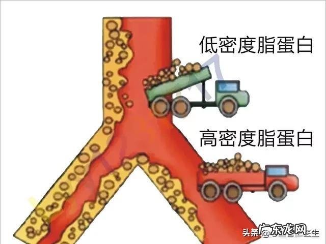反应蛋白高会是哪些病因？