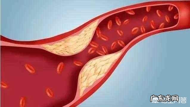 未雨绸缪,常喝保健药的行为可取吗