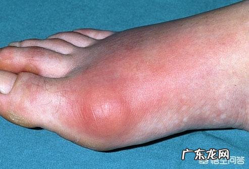 未雨绸缪,常喝保健药的行为可取吗