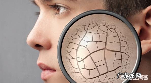 脸上粗糙、干,洗完脸脸上摸着有白屑是怎么回事?