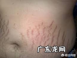 想要减掉40斤，最短需要多长时间不会出现皮肤松弛的现象？