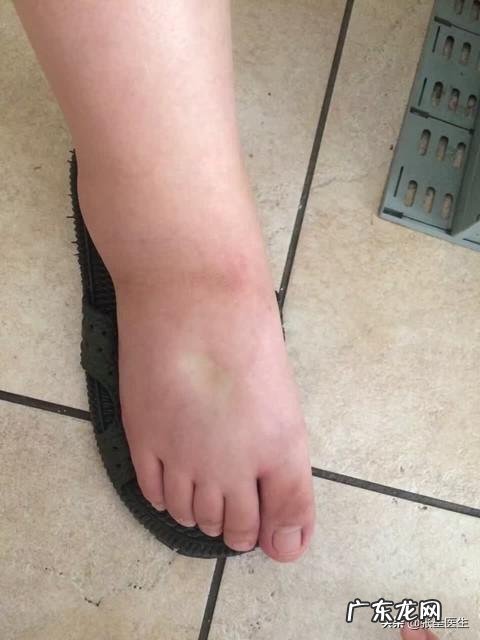 肾好不好,从什么地方能看出来如何保养