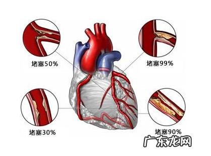 冠心病人得了糖尿病,饭前饭后血糖指标应控制在多少之内