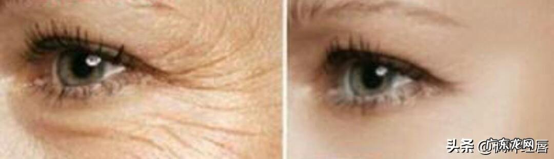 网友们有什么好的洗发水推荐吗？