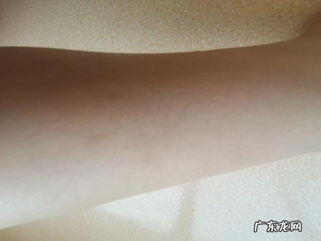 激光去唇毛的价格表 激光脱毛唇毛真的会永久吗