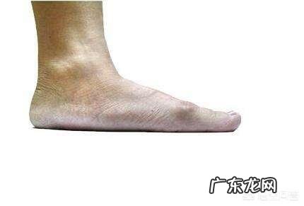 国家征兵体检为什么脚底板平,不能应征入伍呢