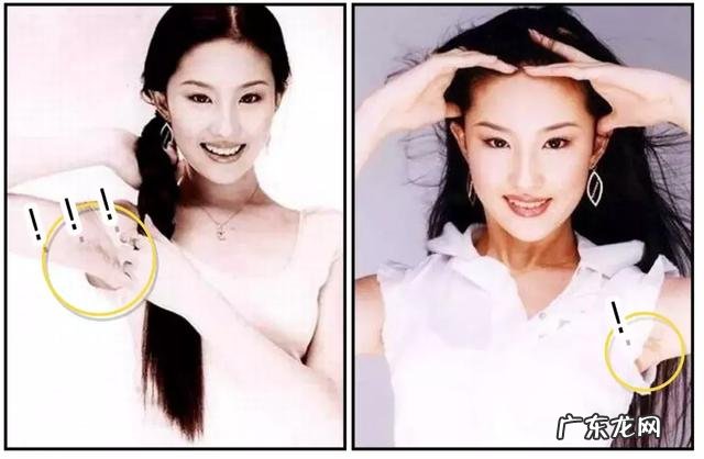 女生做手术脱毛 目前公认最好的脱毛方法