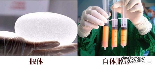 做了假体丰胸手术之后会影响以后给孩子哺乳吗? 胸假体会影响哺乳吗