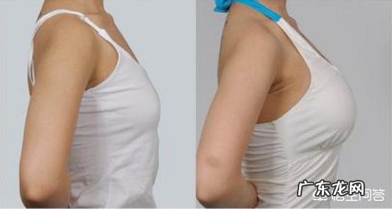 做了假体丰胸手术之后会影响以后给孩子哺乳吗? 胸假体会影响哺乳吗