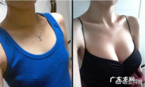 做了假体丰胸手术之后会影响以后给孩子哺乳吗? 胸假体会影响哺乳吗