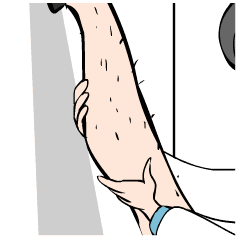 冰点脱毛真的能永久吗 永久脱毛的最好最科学的方法