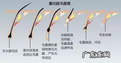 脱毛方法哪种最好女生 有效的脱毛方法都有哪些