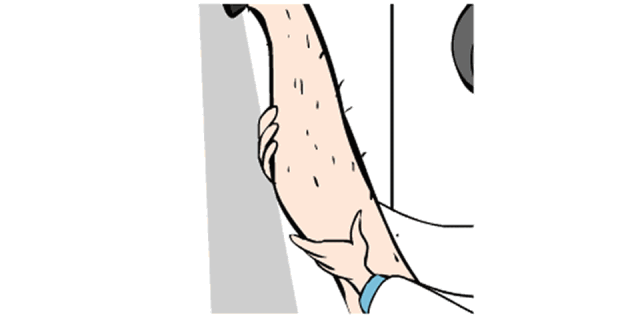 鸭脱毛最好方法 皮肤白多毛的适合哪种脱毛方法