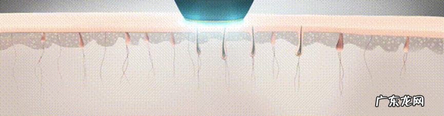 夏天什么脱毛效果最好 夏天脱毛需要注意什么