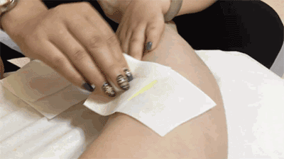 在家自制脱毛方法 人体脱毛用什么方法