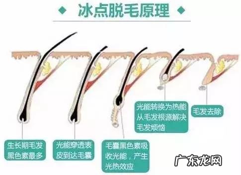 在家自制脱毛方法 人体脱毛用什么方法