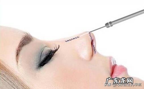 线雕隆鼻的影响,线雕隆鼻有什么危害?