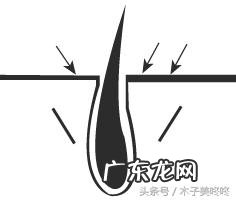 哪种脱毛最好最舒服 脱毛最好选什么