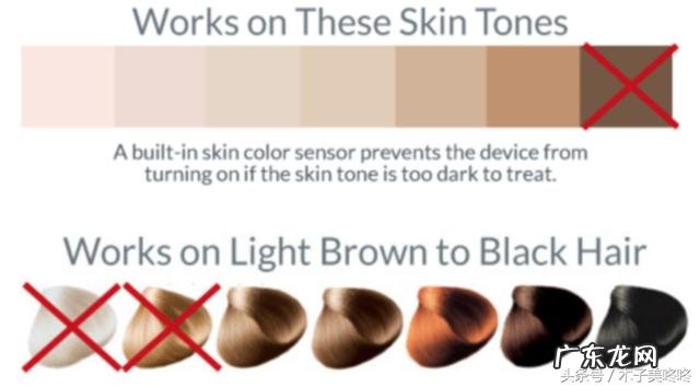 哪种脱毛最好最舒服 脱毛最好选什么