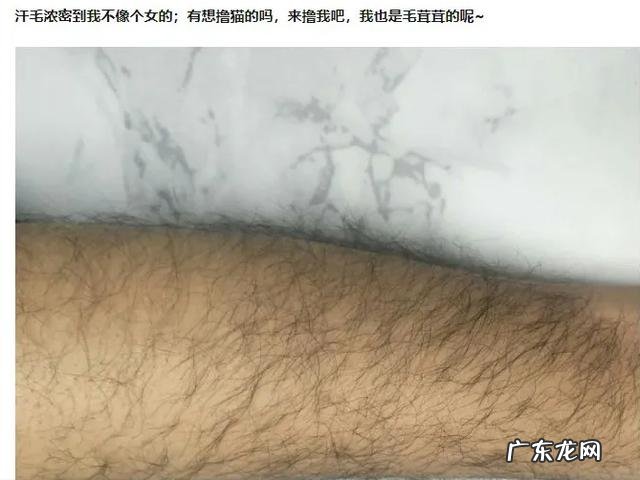 女孩手臂汗毛多能脱毛吗 女生汗毛长怎么脱毛