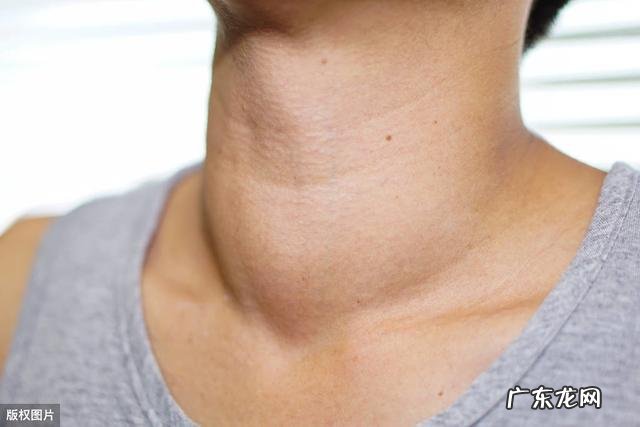 甲状腺功能减退是什么原因引起的？