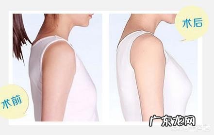 自体脂肪填充隆胸和假体隆胸的区别?