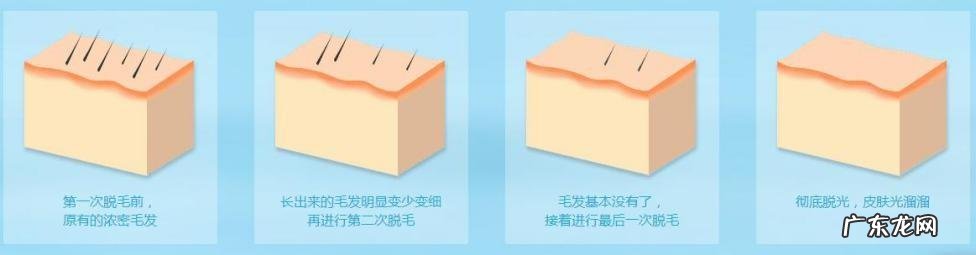 如何脱毛 女孩子脱毛妙招