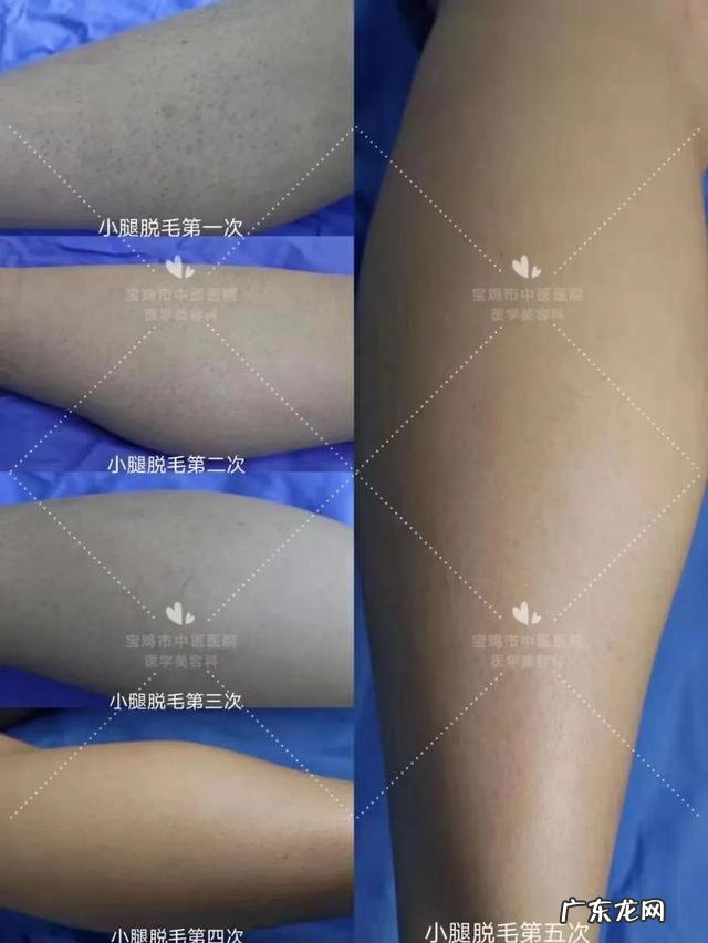 鹅怎样脱毛最干净 脱毛哪种最干净