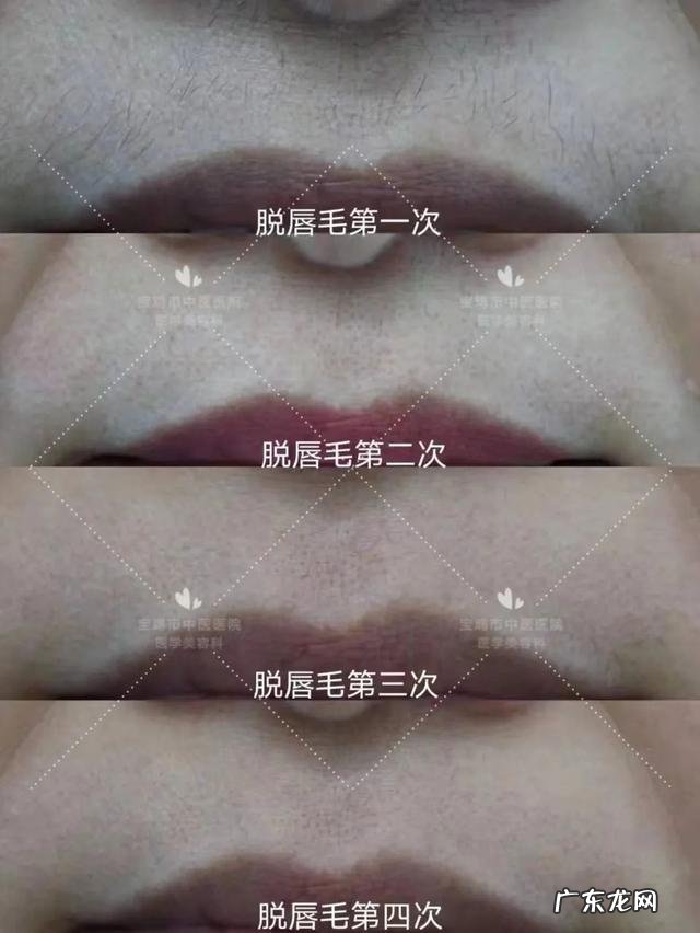 鹅怎样脱毛最干净 脱毛哪种最干净