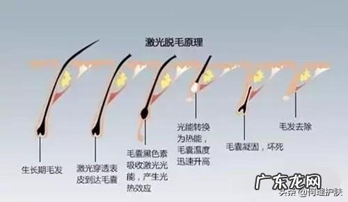 长期用脱毛膏脱毛 用脱毛膏脱毛方法