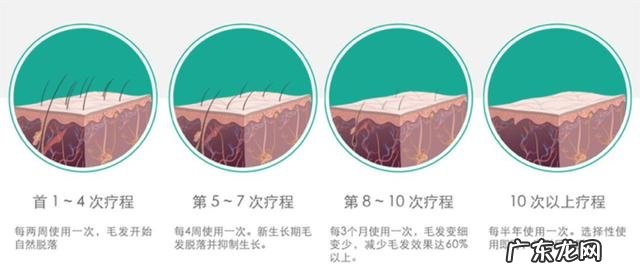 什么脱毛最彻底 脱毛最好选什么