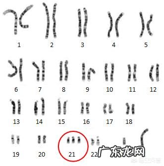 唐筛过了有必要做无创吗?