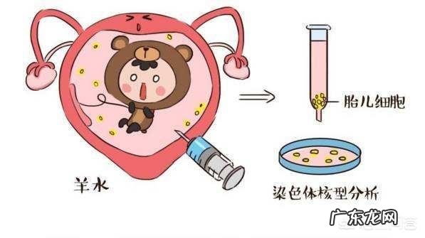 唐筛过了有必要做无创吗?