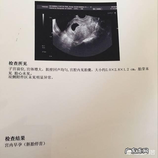 孕14周反应消失也没有胎动，不会是胎停了吧？