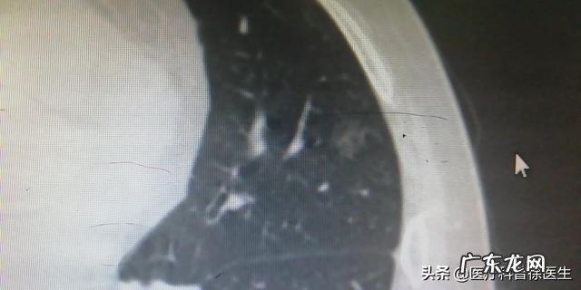 癌症 为什么现在人们生活好了,得病的人越来越多?