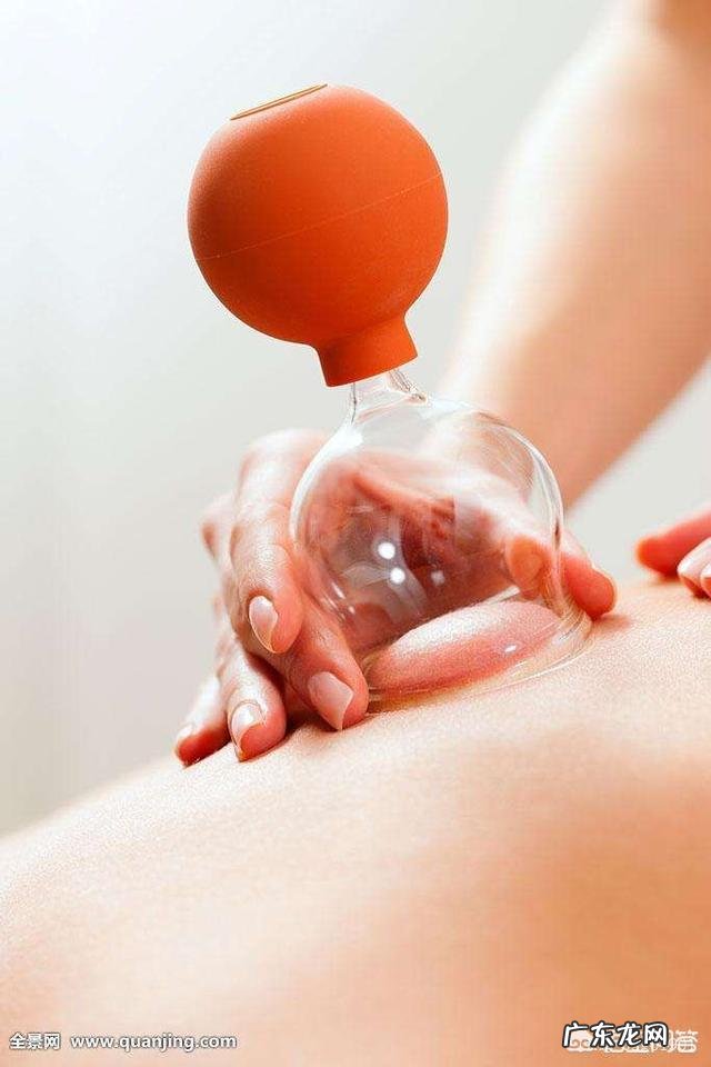 拔罐可祛湿活血,孕妇可以拔罐吗?