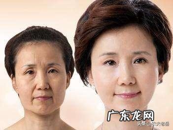 法令纹到底有多显老?如何预防法令纹?