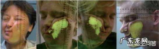 法令纹到底有多显老?如何预防法令纹?