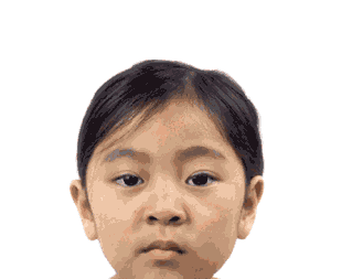 如何通过医美手段祛法令纹?