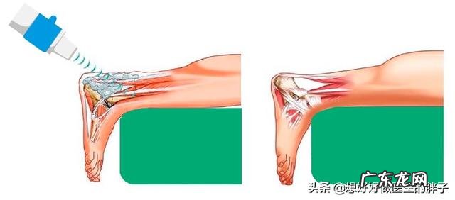 身高160体重135斤,想在6个月内瘦到100斤,该怎么减肥