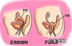 为什么现在越来越多的产妇会去做产后恢复？