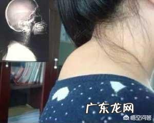 富贵包,最佳处理方式是穴位按摩,对此,你认可吗?